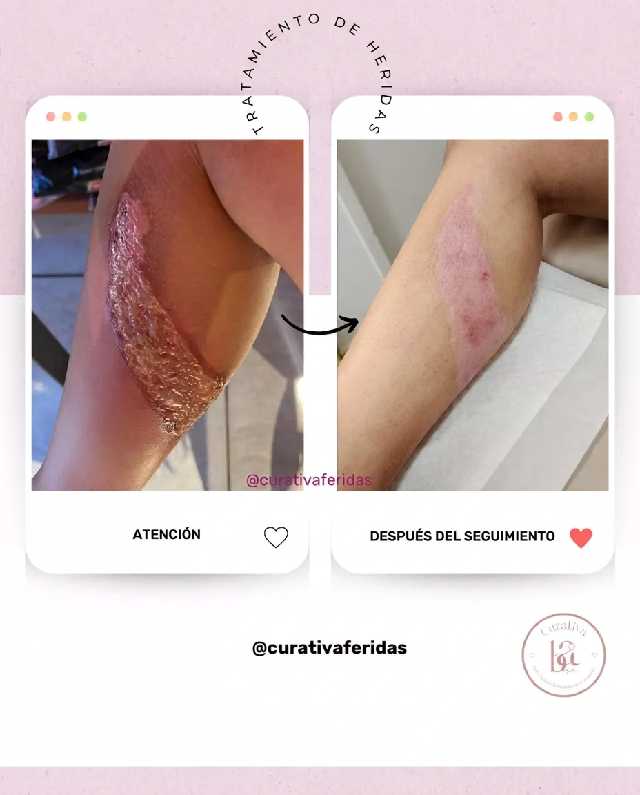 Caso 1