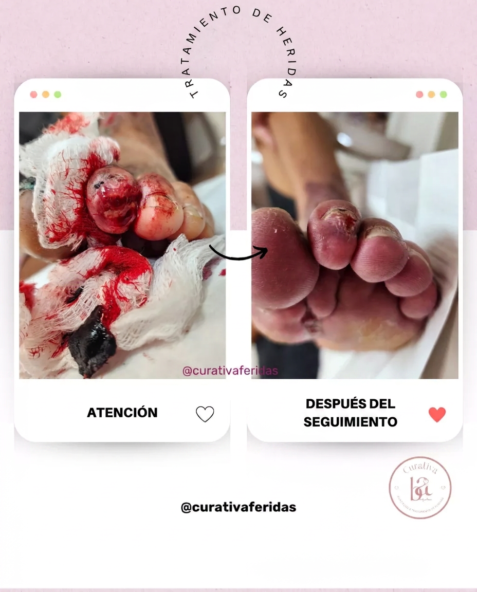 Caso 4