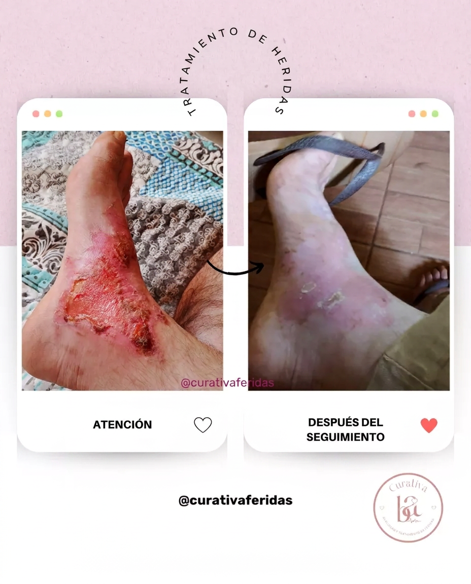 Caso 7